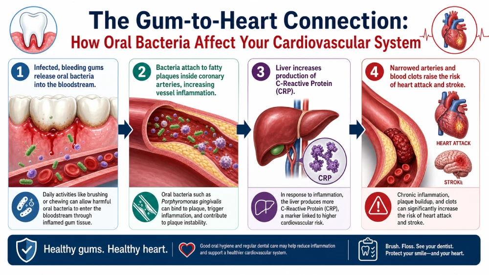 Infographic illustrating how oral bacteria from gum disease enter arteries, trigger C-reactive protein inflammation, and increase heart attack and stroke risk