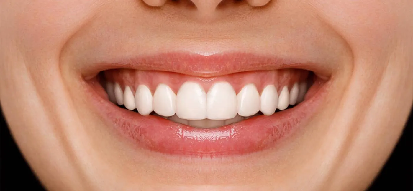 Smile after professional whitening at Smile Care Studio