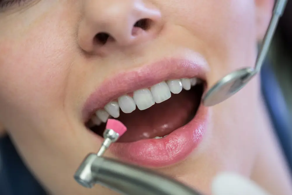 Deep Cleaning & Periodontal Th