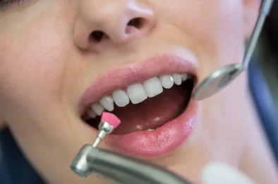 Deep Cleaning & Periodontal Th